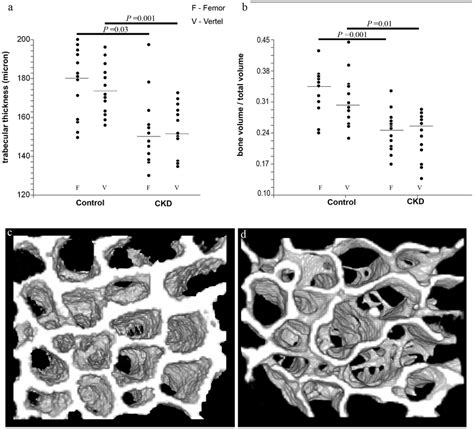 trabecular thickness measurement|where is trabecular bone found.